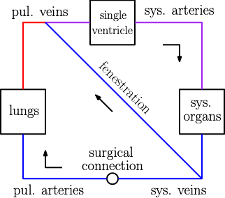 Fontan Patients Figure