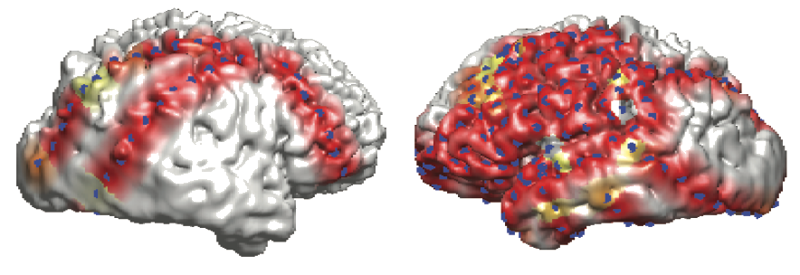 Computational Neuroscience